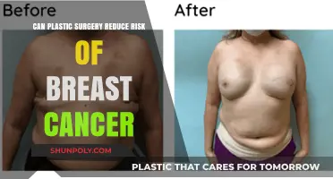 Plastic Surgery and Breast Cancer Risk: Exploring the Potential Connection