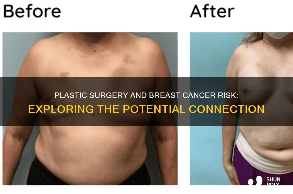 can plastic surgery reduce risk of breast cancer