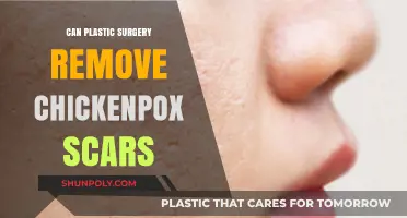 Plastic Surgery Solutions for Chickenpox Scars: What You Need to Know