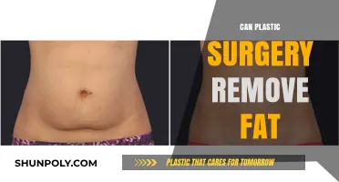 Can Plastic Surgery Effectively Remove Fat? Exploring Liposuction and Beyond