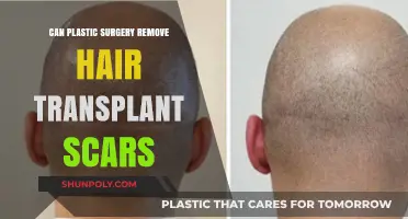 Can Plastic Surgery Effectively Remove Hair Transplant Scars?