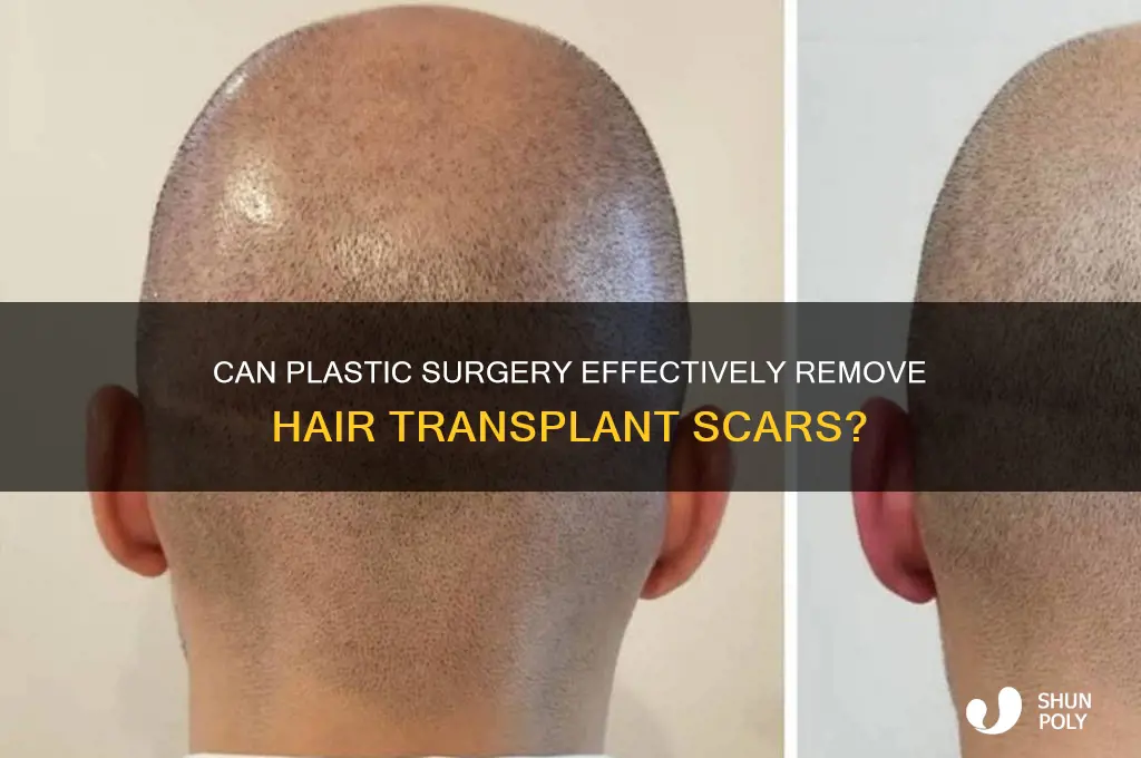 can plastic surgery remove hair transplant scars
