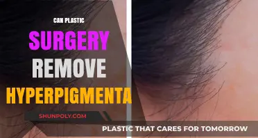 Can Plastic Surgery Effectively Treat Hyperpigmentation? Expert Insights