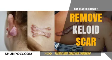 Can Plastic Surgery Effectively Remove Keloid Scars? Expert Insights
