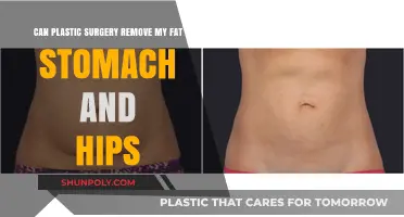 Plastic Surgery Solutions for Fat Stomach and Hips: What Works?