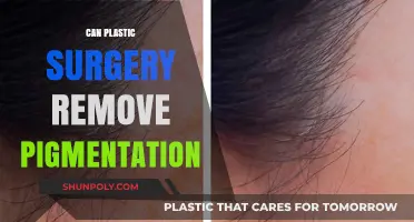 Can Plastic Surgery Effectively Remove Skin Pigmentation? Expert Insights