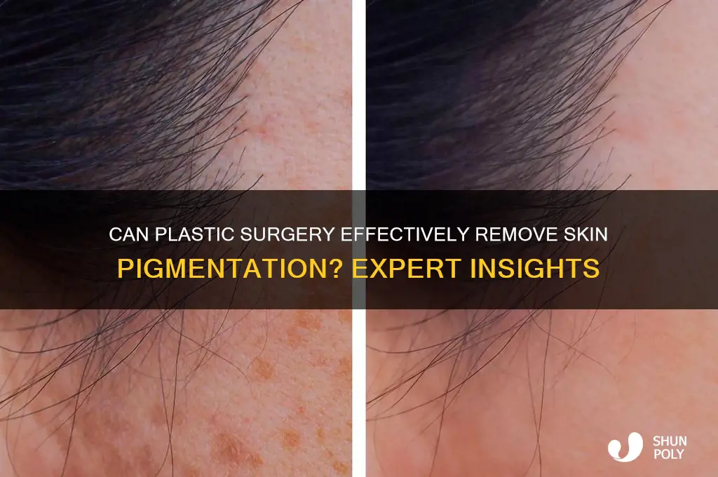 can plastic surgery remove pigmentation