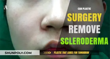 Can Plastic Surgery Treat Scleroderma? Exploring Options and Limitations