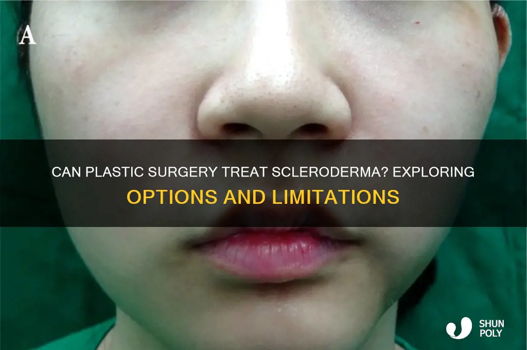 can plastic surgery remove scleroderma