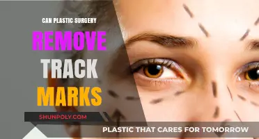 Can Plastic Surgery Erase Track Marks? Exploring Options and Limitations