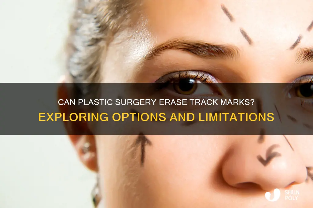 can plastic surgery remove track marks