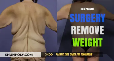 Can Plastic Surgery Aid in Weight Loss? Facts and Myths