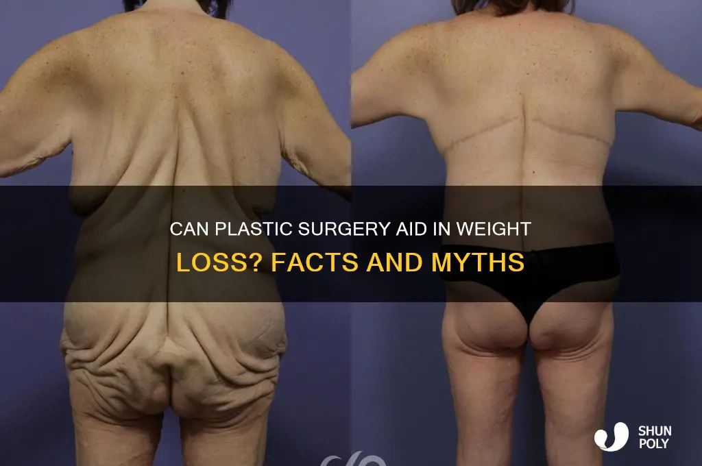 can plastic surgery remove weight