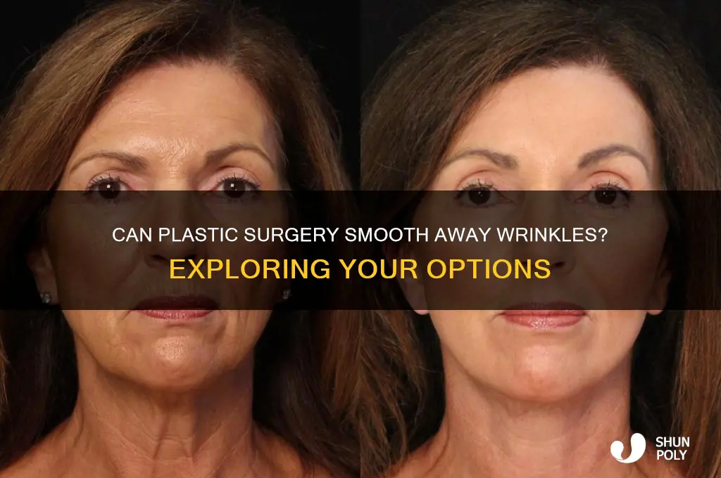 can plastic surgery remove wrinkles