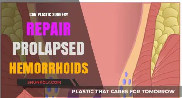 Can Plastic Surgery Repair Prolapsed Hemorrhoids? Exploring Treatment Options
