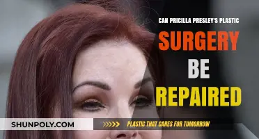 Can Priscilla Presley Reverse Her Plastic Surgery Results?
