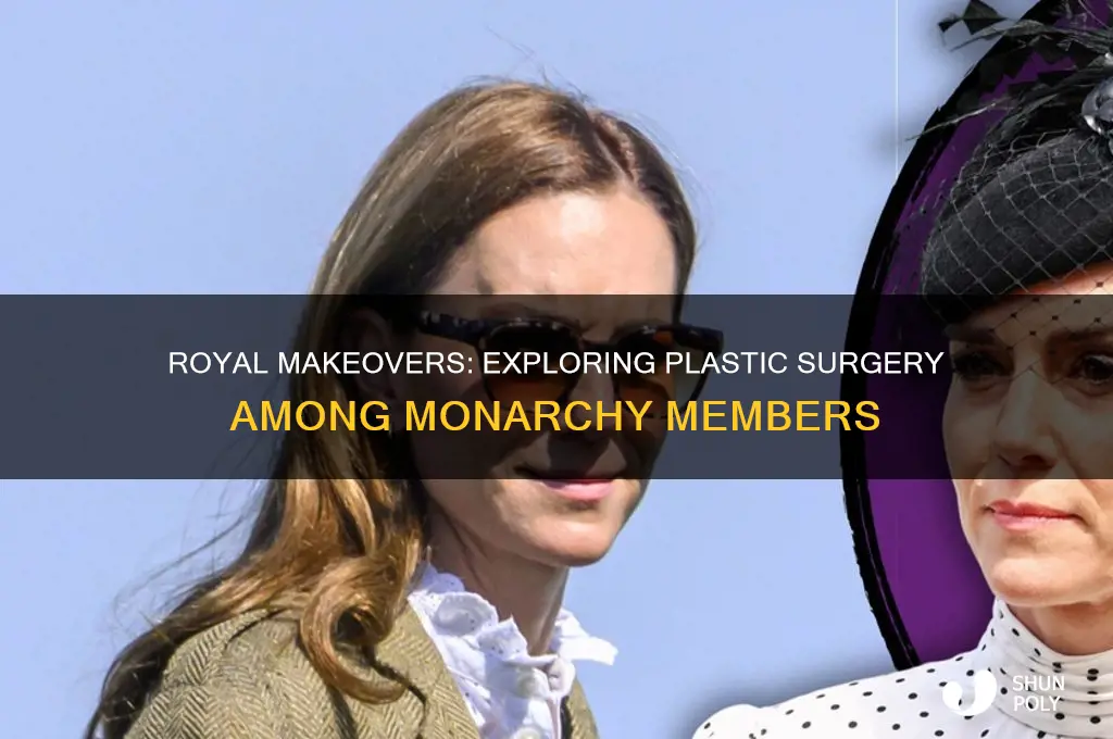 can royals get plastic surgery