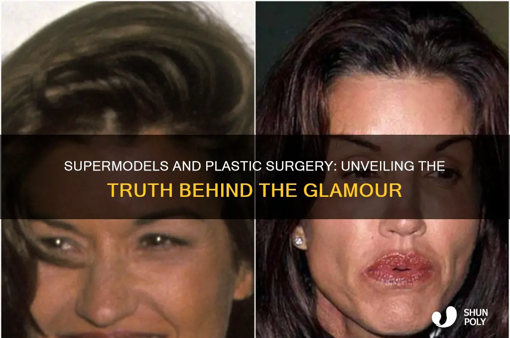can supermodels have plastic surgery