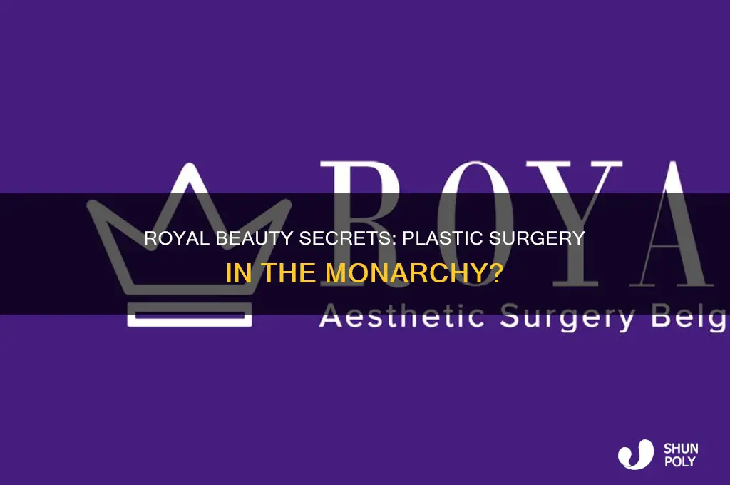 can the royal family get plastic surgery