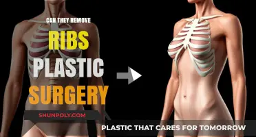 Can Ribs Be Removed in Plastic Surgery? Exploring the Procedure and Risks