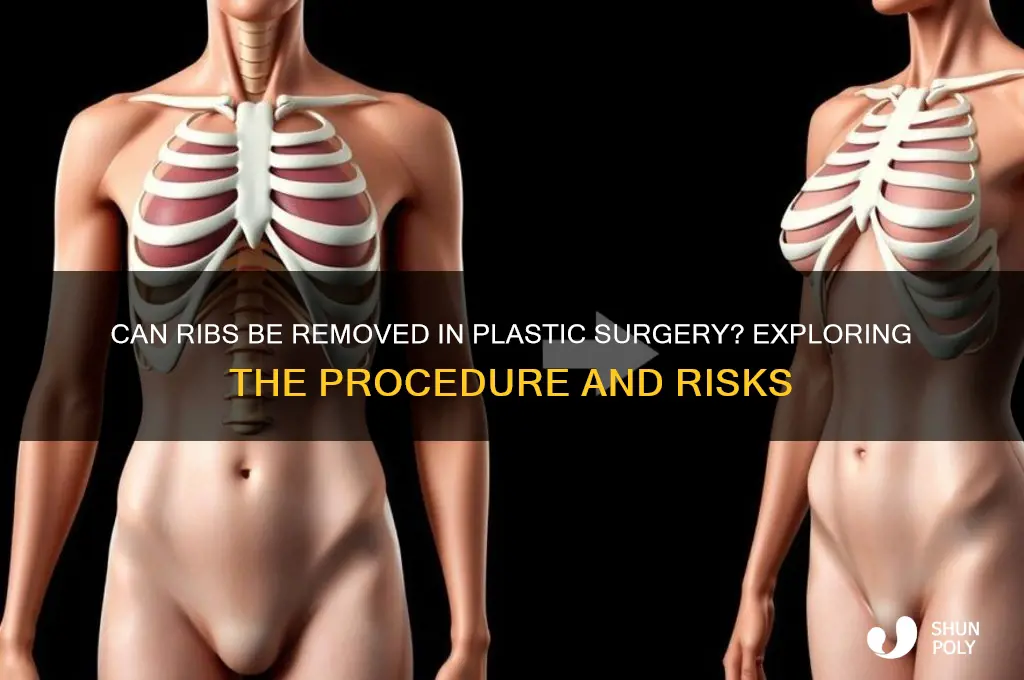 can they remove ribs plastic surgery