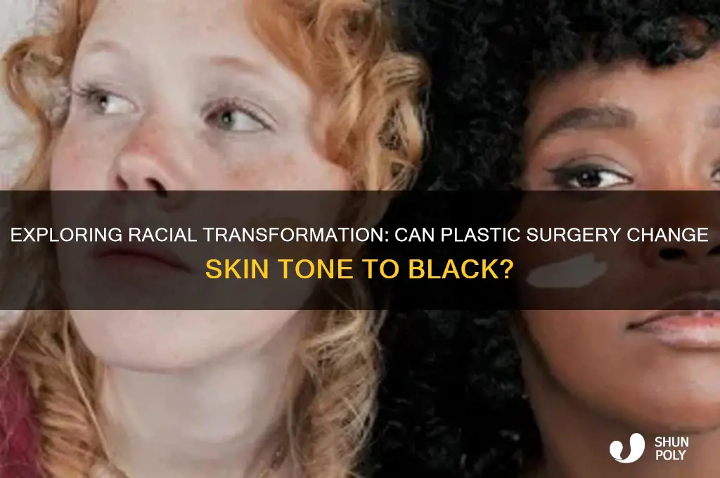 can u get plastic surgery to be black