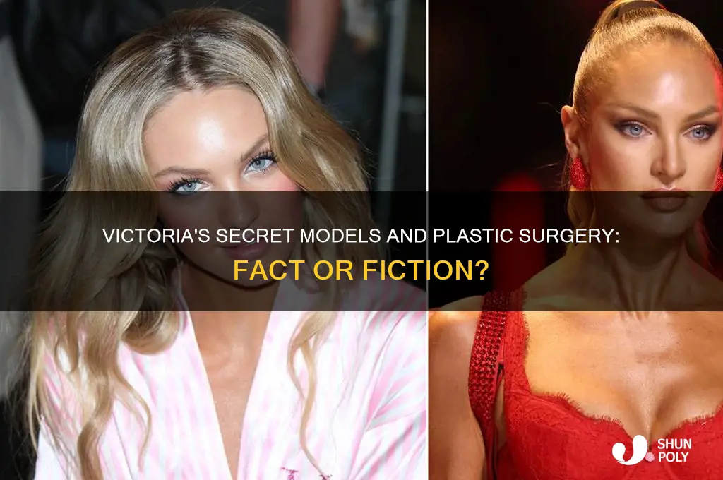 can victoria secret models get plastic surgery