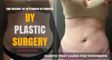 Can Plastic Surgery Eliminate Visceral Stomach Fat? Facts Revealed