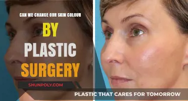 Can Plastic Surgery Permanently Alter Skin Tone? Facts and Limits
