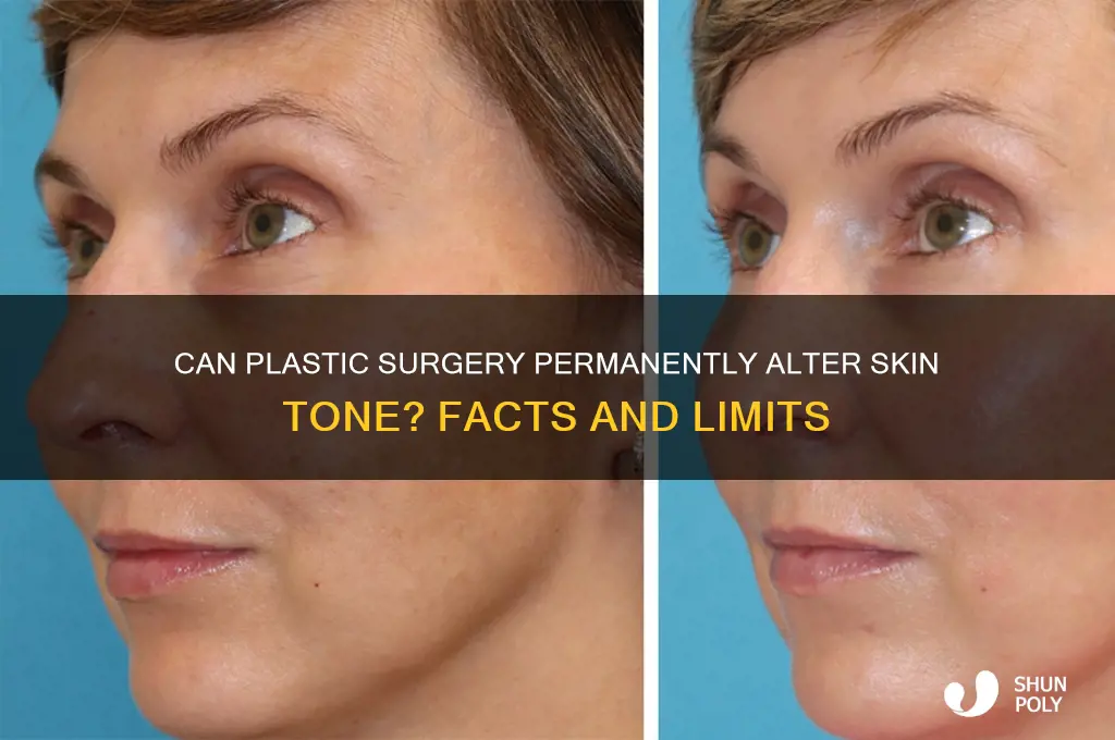 can we change our skin colour by plastic surgery