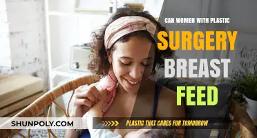 Breastfeeding After Breast Augmentation: What Women Need to Know