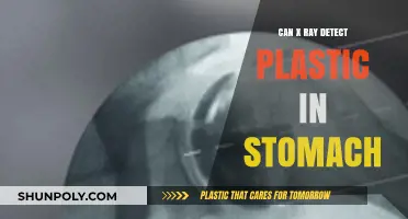 Unveiling the Truth: Can X-Rays Really Detect Plastic in Your Stomach?