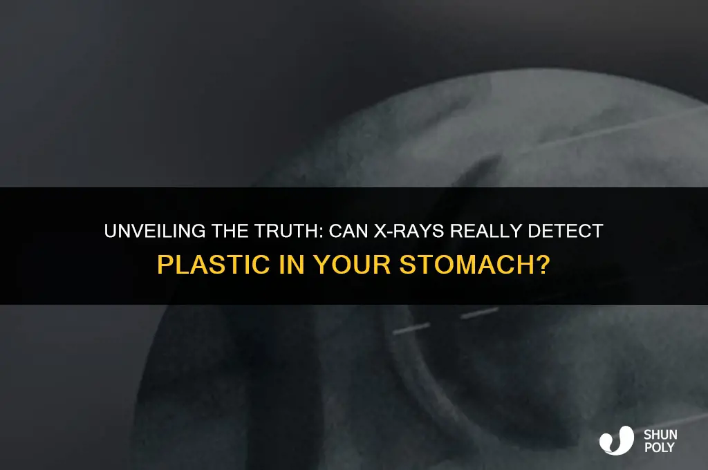 can x ray detect plastic in stomach