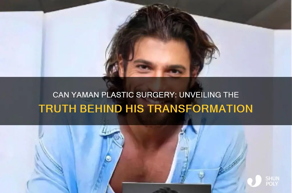 can yaman plastic surgery