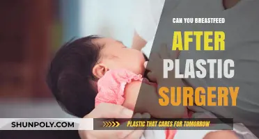 Breastfeeding After Plastic Surgery: What New Moms Need to Know