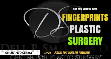 Can Plastic Surgery Alter Your Fingerprints? Unveiling the Truth
