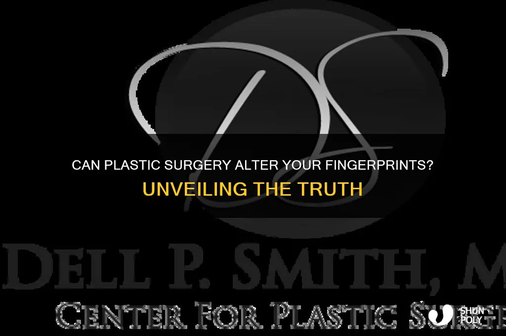 can you change your fingerprints plastic surgery