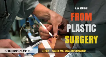 Plastic Surgery Risks: Can Cosmetic Procedures Lead to Fatal Outcomes?