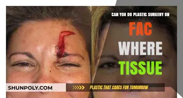 Facial Plastic Surgery: Exploring Tissue-Based Procedures and Possibilities