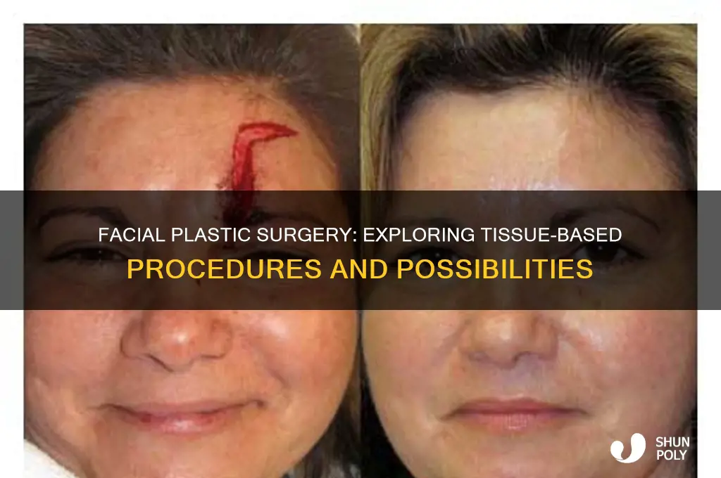 can you do plastic surgery on fac where tissue
