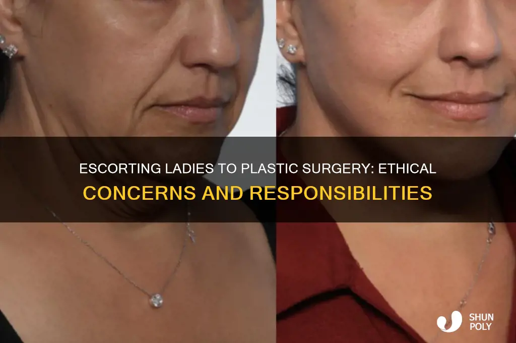 can you escort these two ladies back to plastic surgery