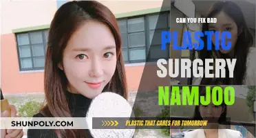 Can Bad Plastic Surgery Be Fixed? Namjoo's Case Explored