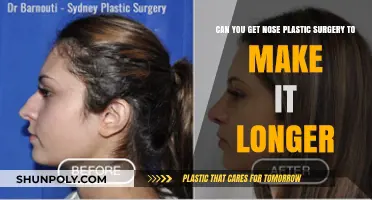 Nose Lengthening Surgery: Can Rhinoplasty Make Your Nose Longer?