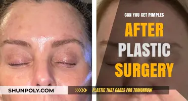 Post-Plastic Surgery Pimples: Causes, Prevention, and Treatment Explained