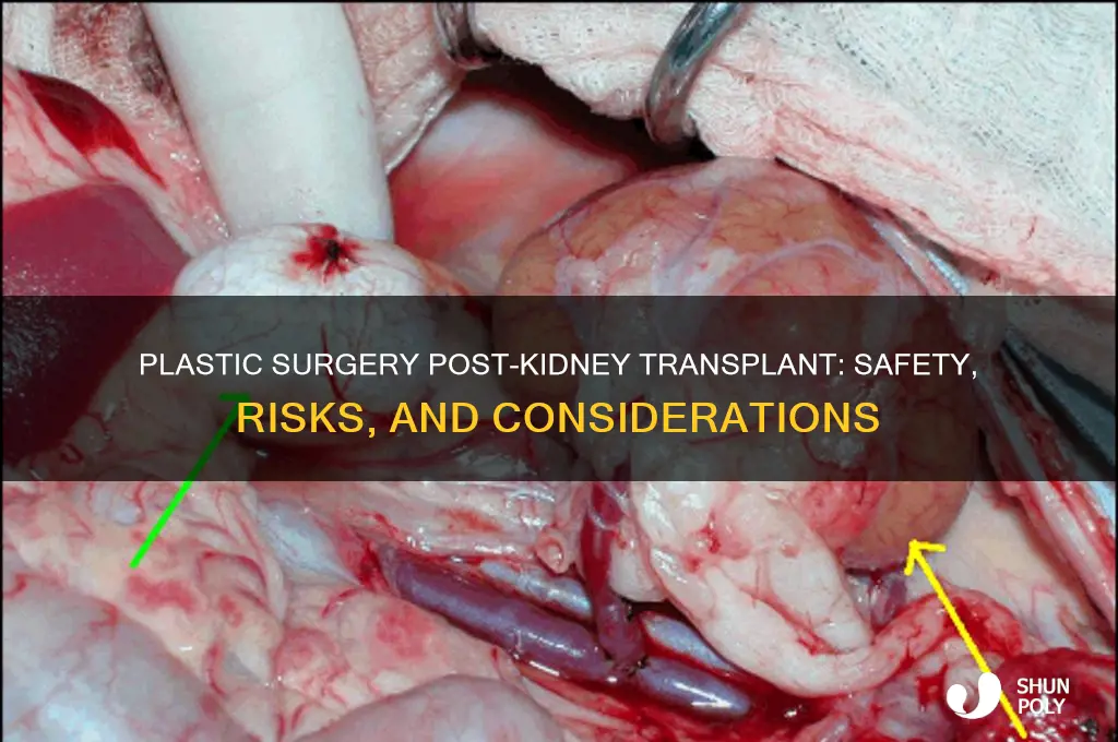 can you get plastic surgery after a kidney transplant