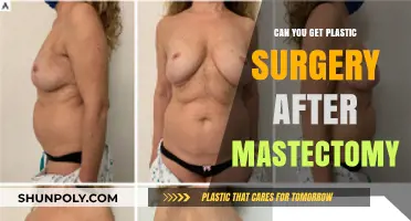 Reconstructing Confidence: Plastic Surgery Options Post-Mastectomy Explained