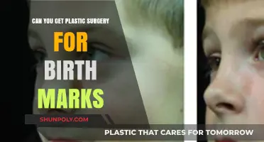 Can Birthmarks Be Removed with Plastic Surgery? Exploring Your Options