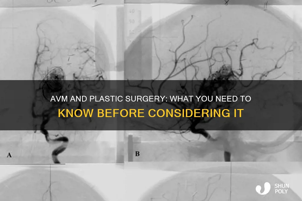 can you get plastic surgery if you have avm