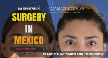 Exploring Plastic Surgery Options in Mexico: What You Need to Know