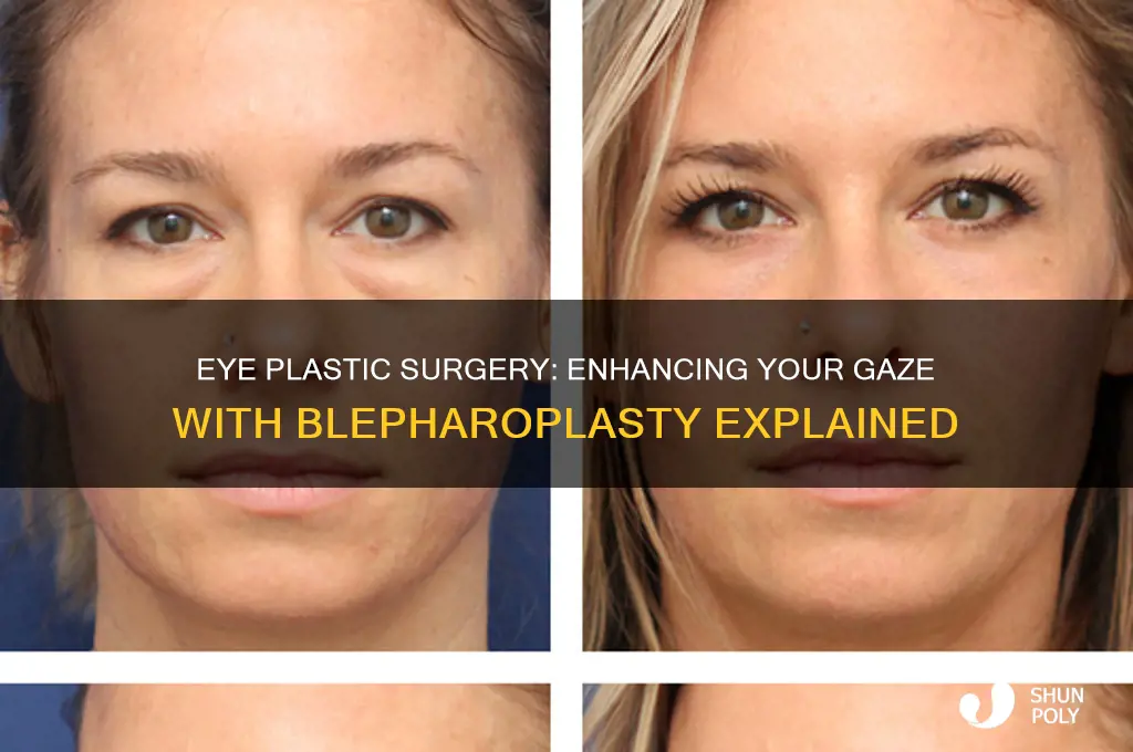 can you get plastic surgery on your eyes
